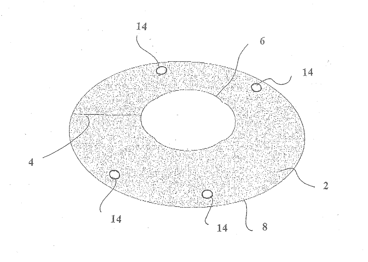 Cosmetic corneal inlay and implantation method thereof