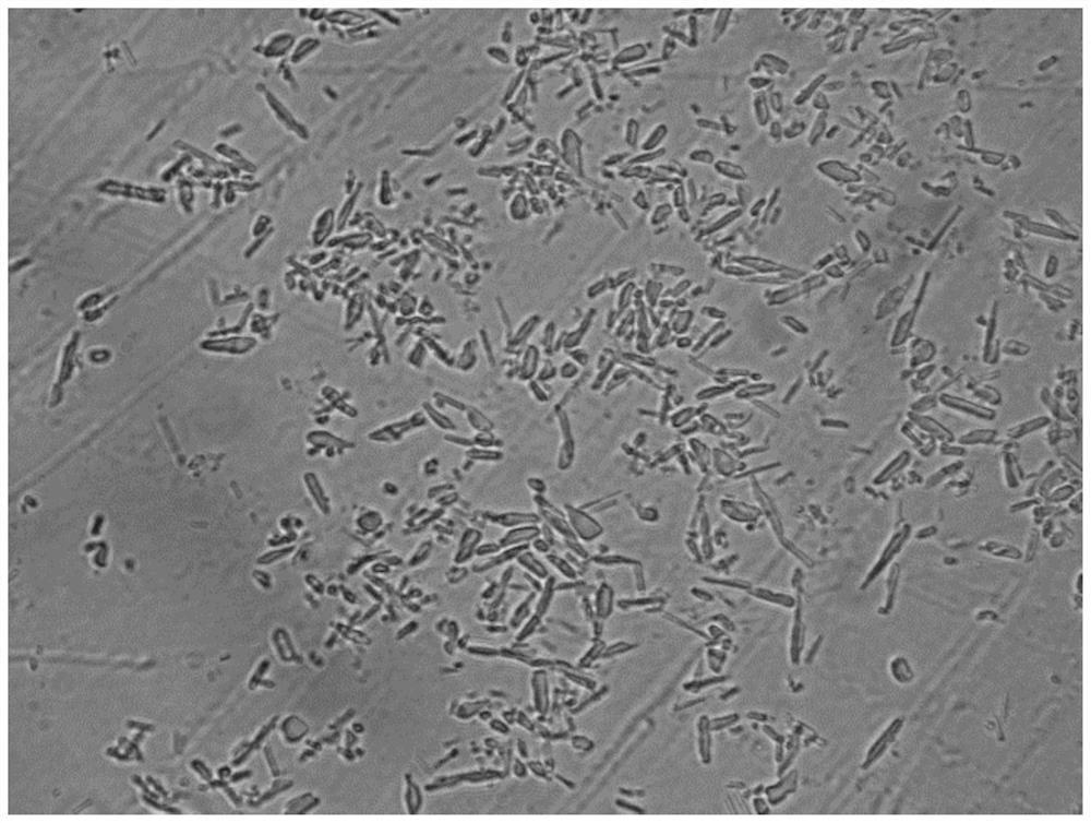 Preparation method of insulin aspart 30 suspension