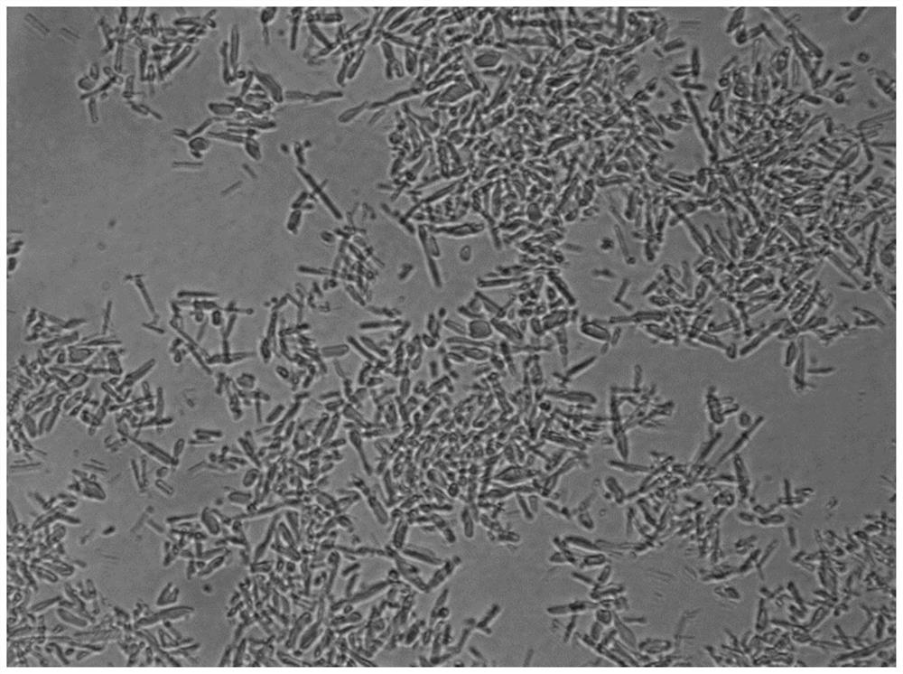 Preparation method of insulin aspart 30 suspension