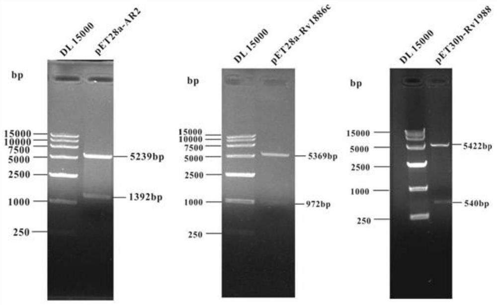 Mycobacterium tuberculosis fusion protein AR2, construction, expression and purification method and application thereof