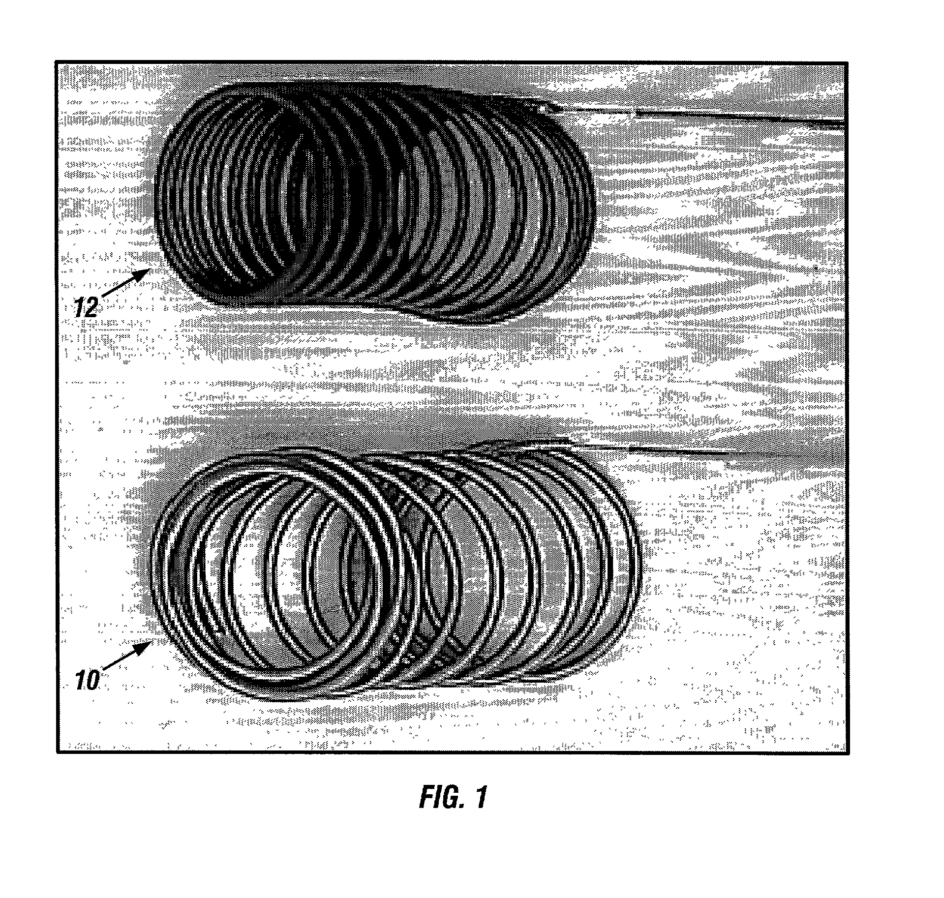 Bioabsorbable polymeric implants and a method of using the same to create occlusions