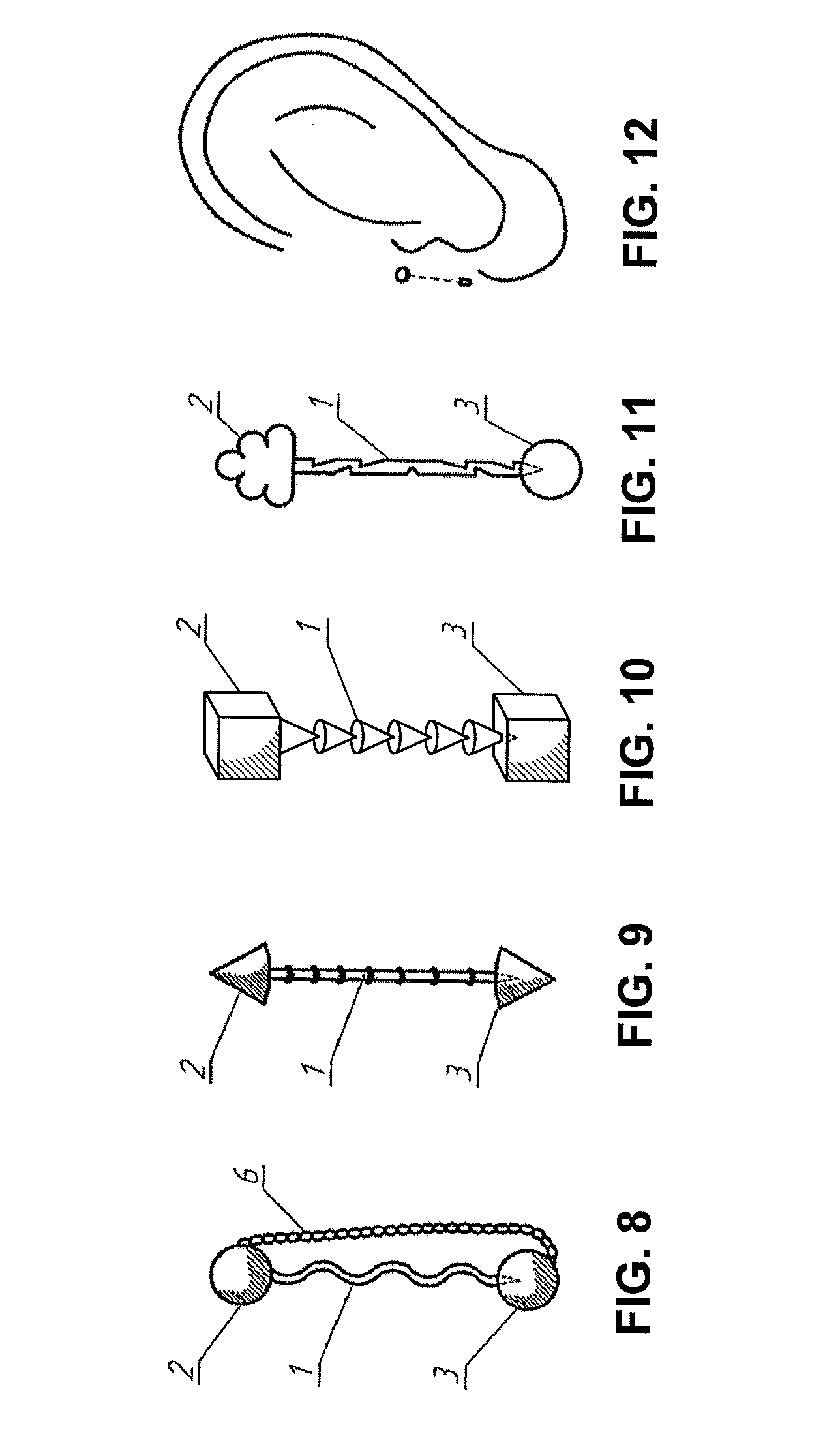 Method for prolonging the action on acupuncture points including for reducing the excessive body weight and for correcting the body, a device and a needle (variants) for carrying out said method