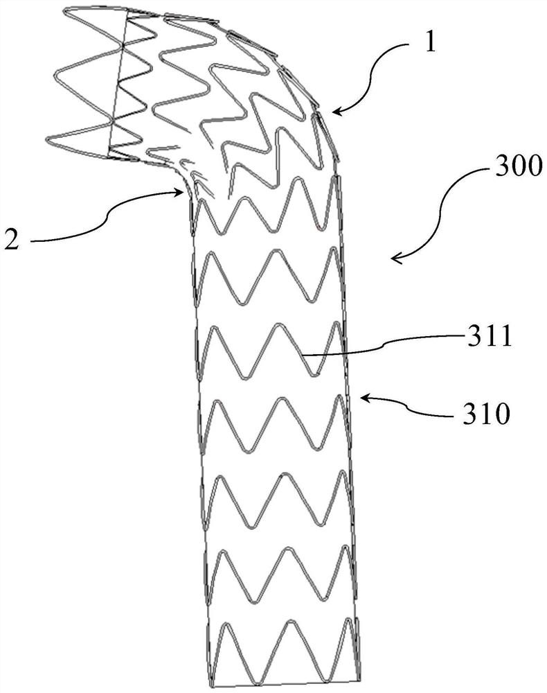 Covered stent