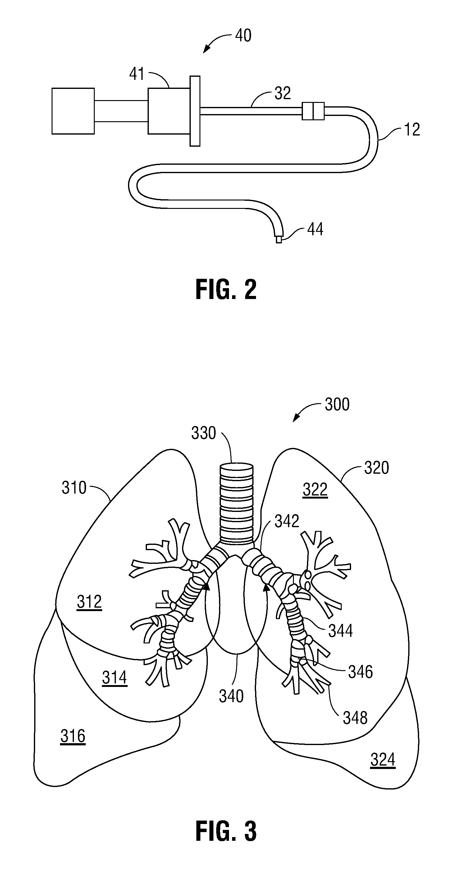 System and method for navigating to target and performing procedure on target utilizing fluoroscopic-based local three dimensional volume reconstruction