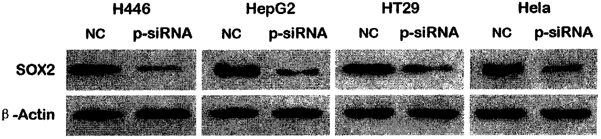Double-stranded p-siRNA molecule and p-siRNA recombinant plasmid for suppressing sox2 gene expression and application thereof