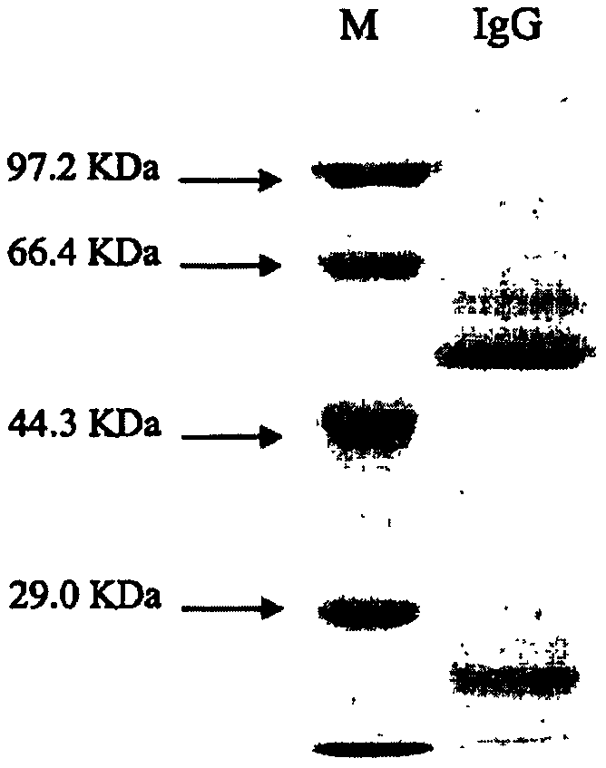 Anti-CBirl hybridoma cell strain and monoclonal antibody produced by same