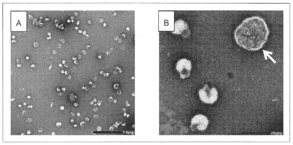 Inactivated whole-virus influenza vaccine and method for preparing same