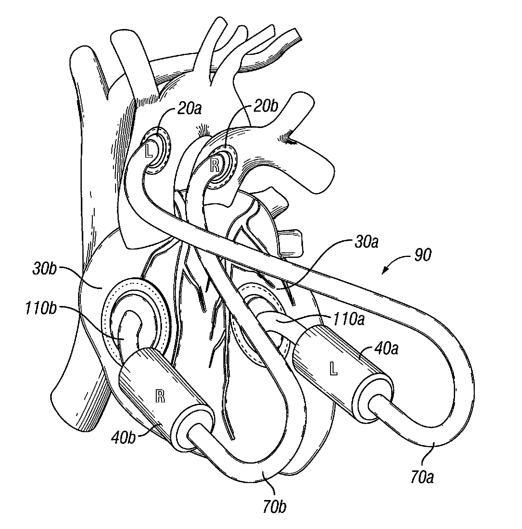 Total artificial heart system for auto-regulating flow and pressure