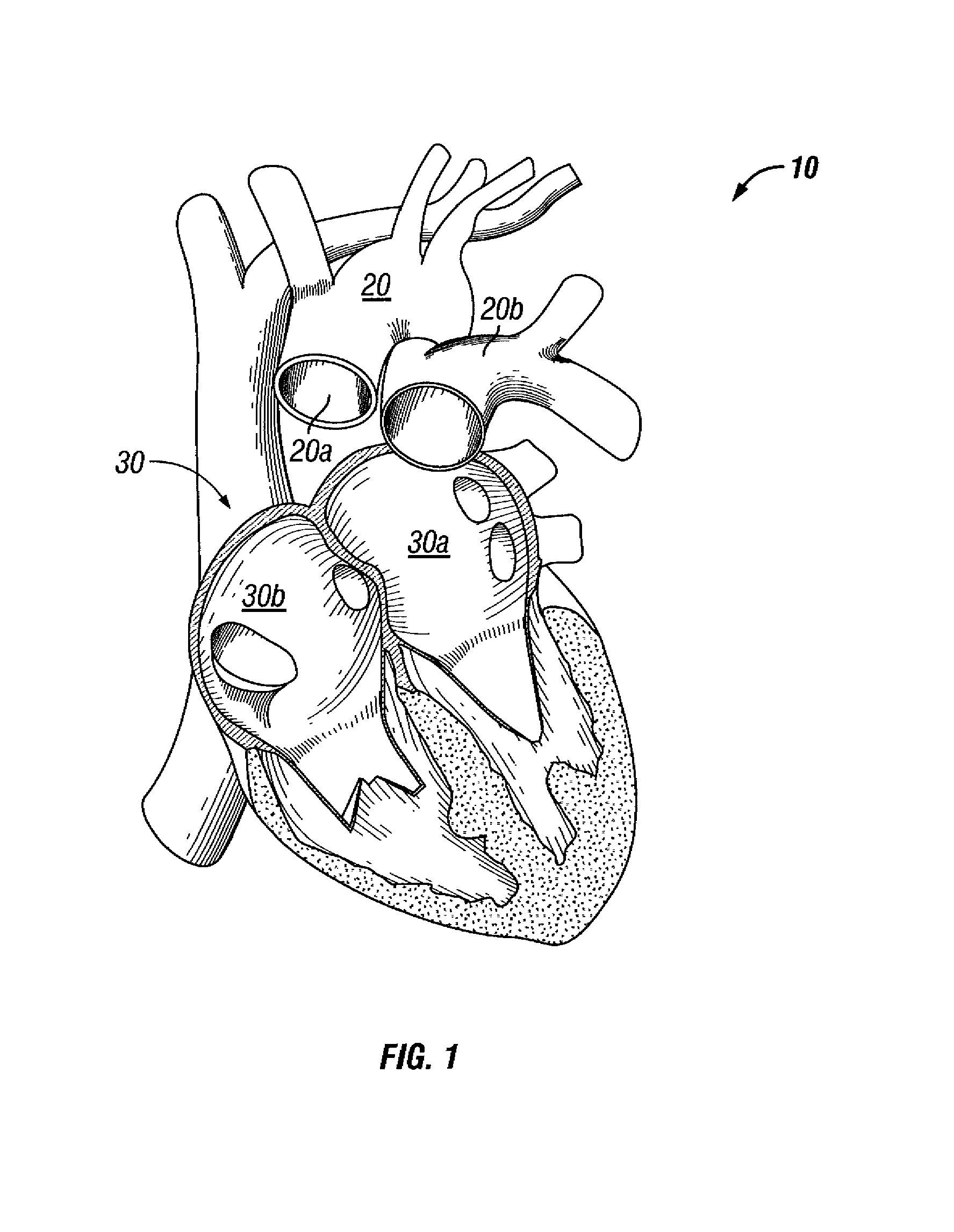 Total artificial heart system for auto-regulating flow and pressure