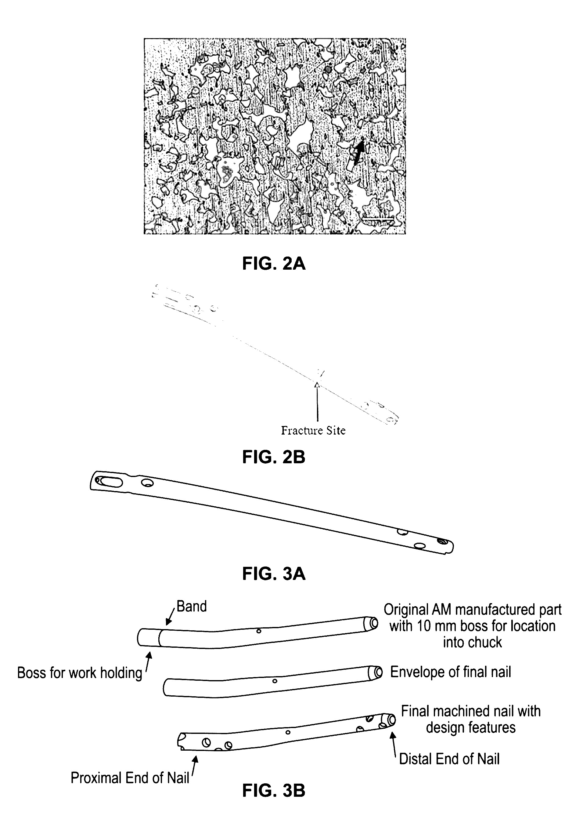 Dmls orthopedic intramedullary device and method of manufacture