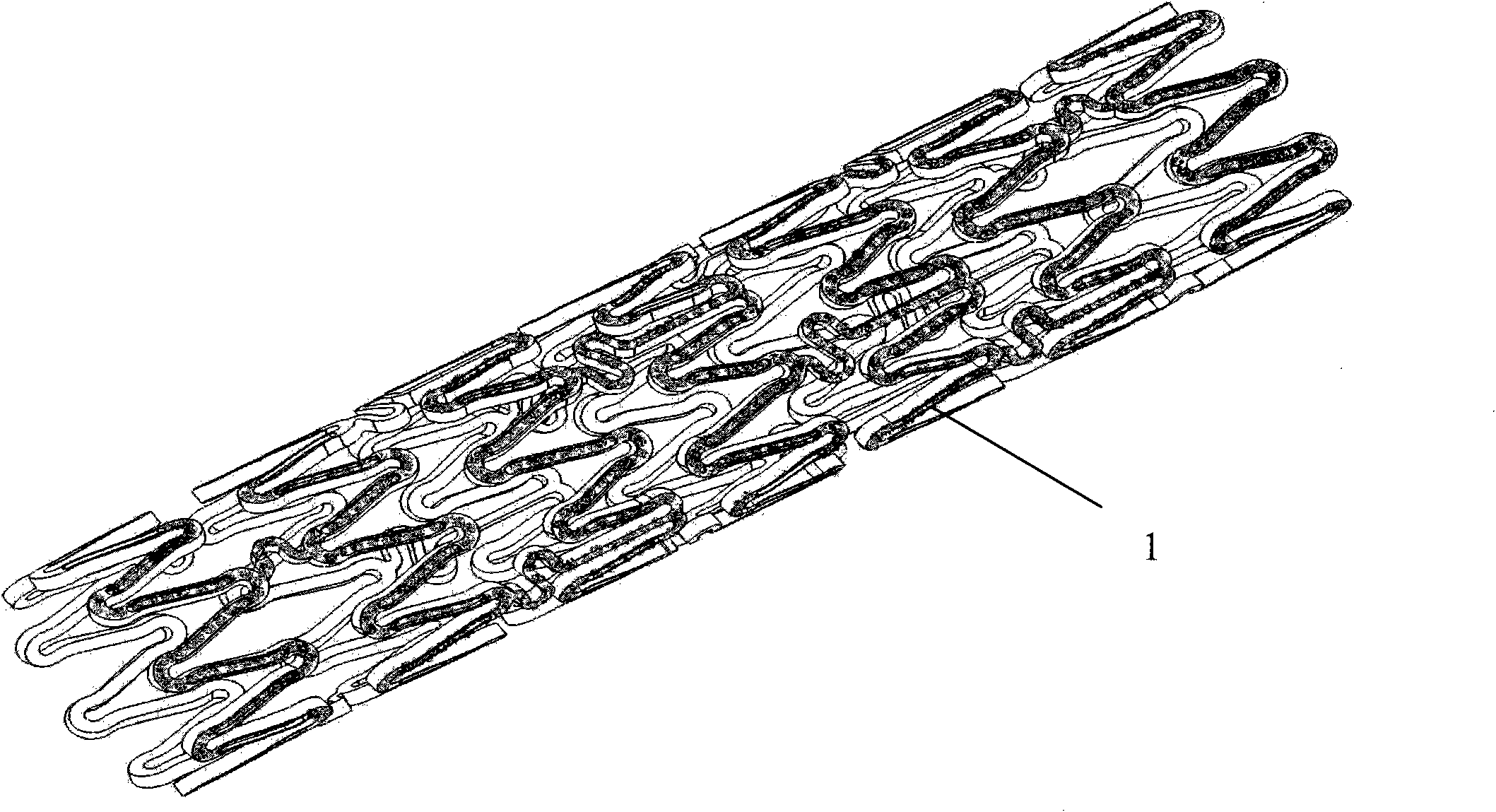 Body lumen drug-carrying bracket and preparation method thereof