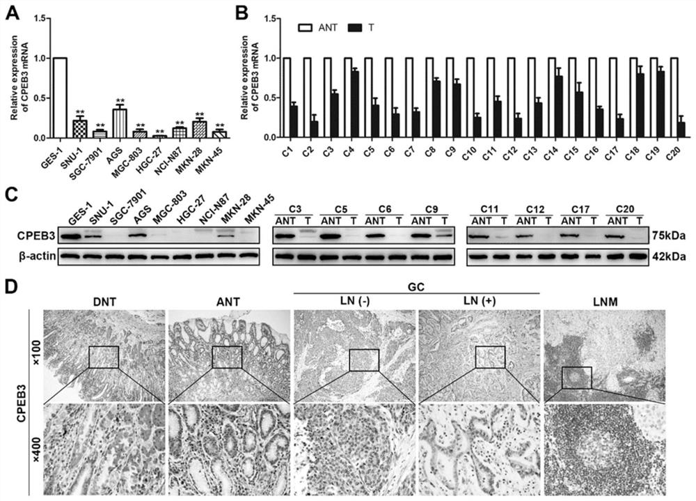 Application of AAV9-CPEB3 in preparation of medicine for treating gastric cancer