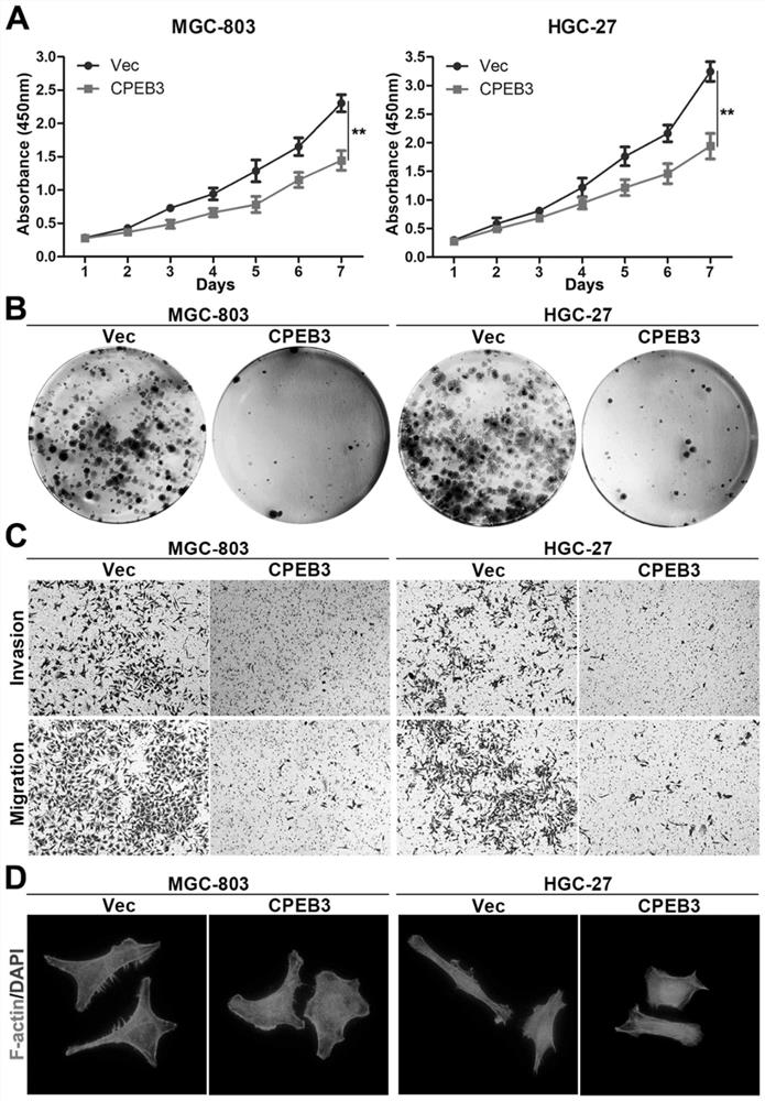 Application of AAV9-CPEB3 in preparation of medicine for treating gastric cancer