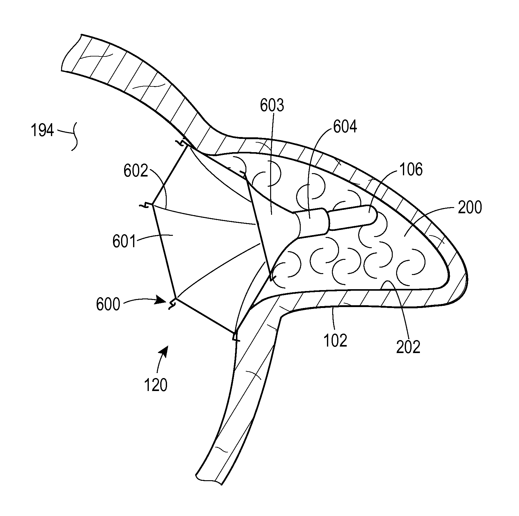 Multimodality left atrial appendage occlusion device