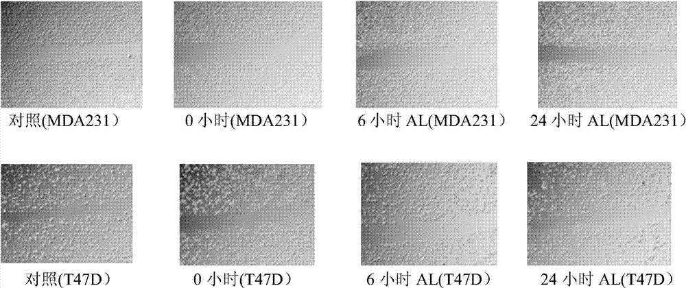 Use of albiflorin in preparation of laryngeal cancer resistant medicines