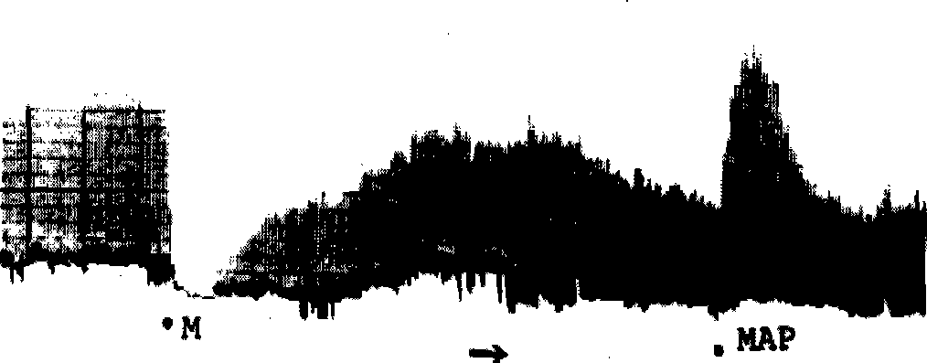 Anti-opium peptide and antagonistic peptide and its application