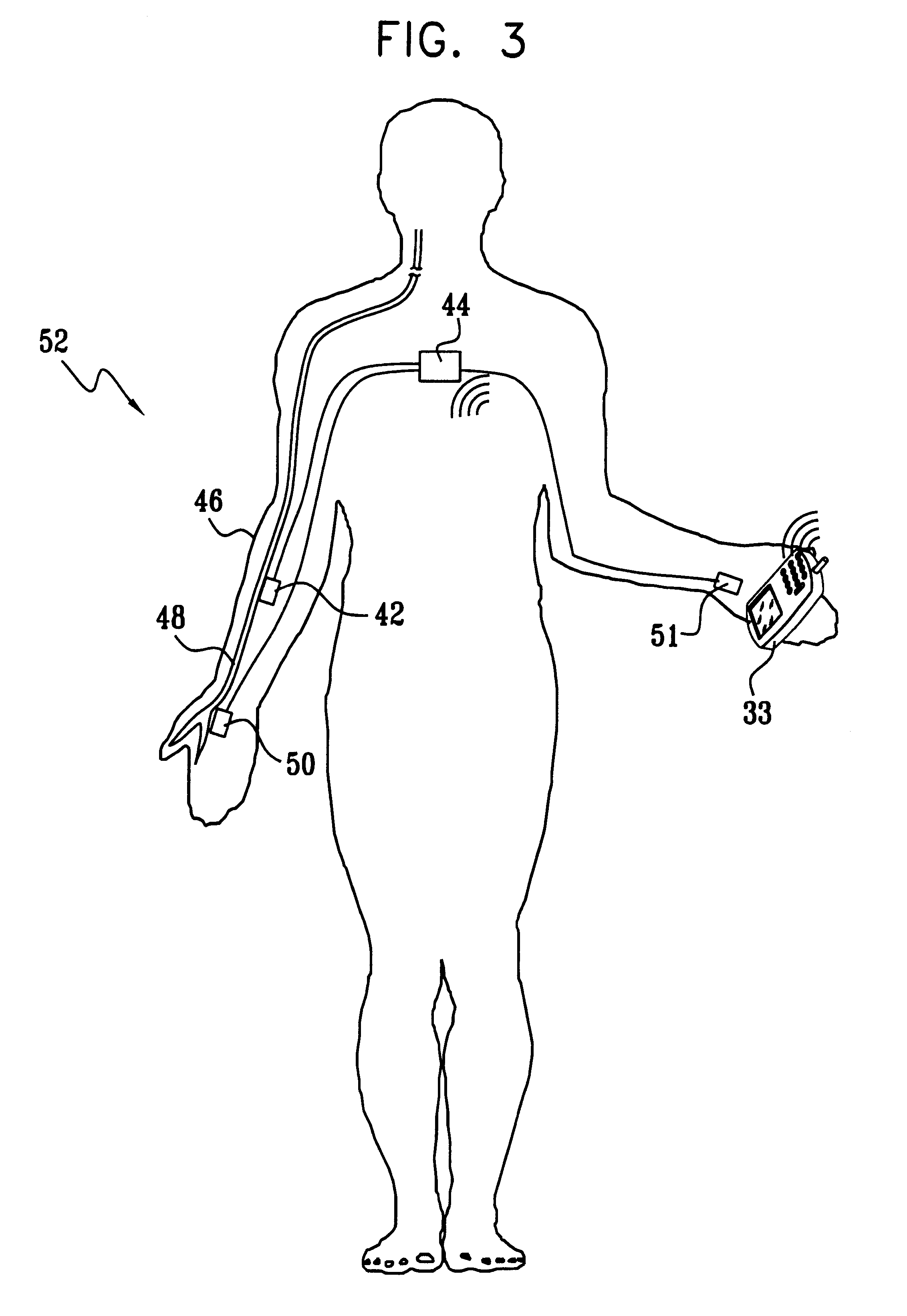 Actuation and control of limbs through motor nerve stimulation