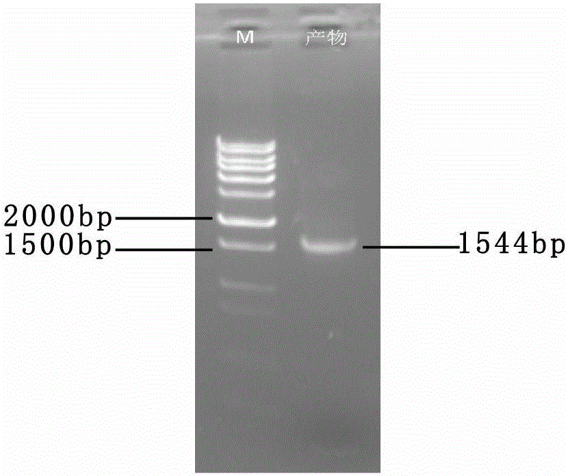Saccharomyces cerevisiae gene engineering bacteria for producing succinic acid and application thereof