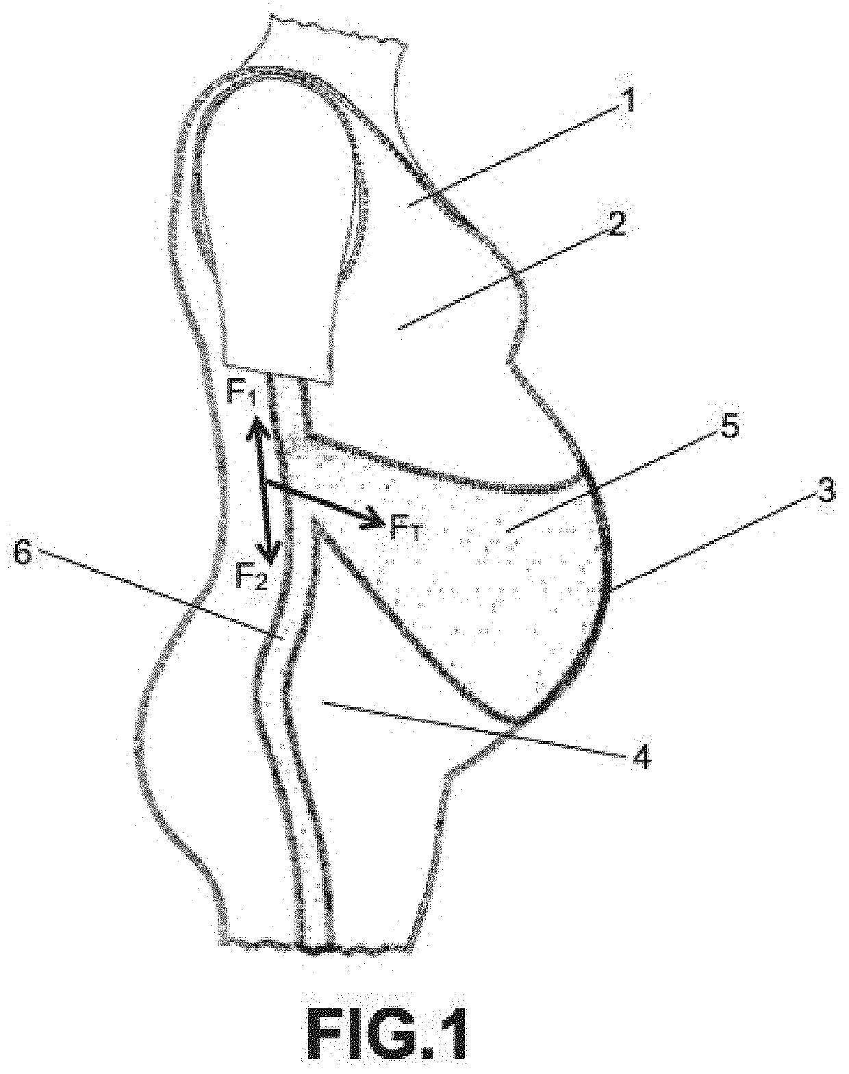 Feminine support device or garment for pregnant mothers' accommodation