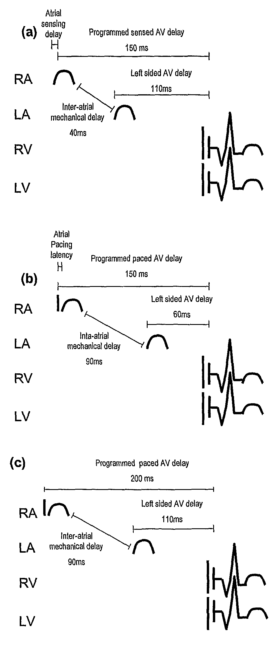 Apparatus and method for programming a pacemaker