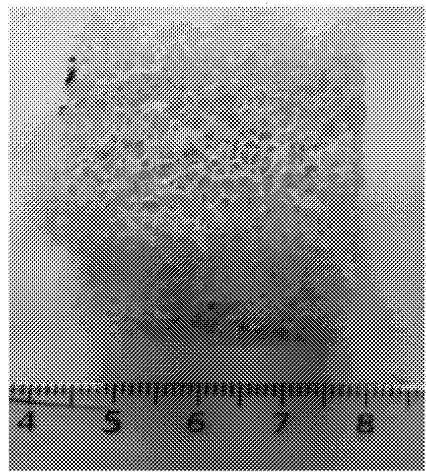 Injectable bone substitutes for augmenting implant fixation