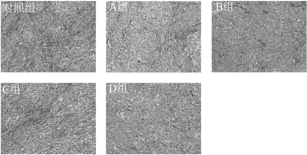 Co-supported polymer micelle and application thereof in pharmacy