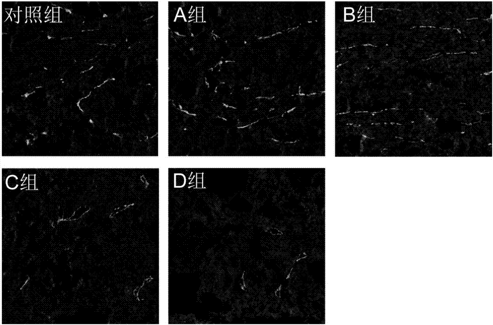 Co-supported polymer micelle and application thereof in pharmacy