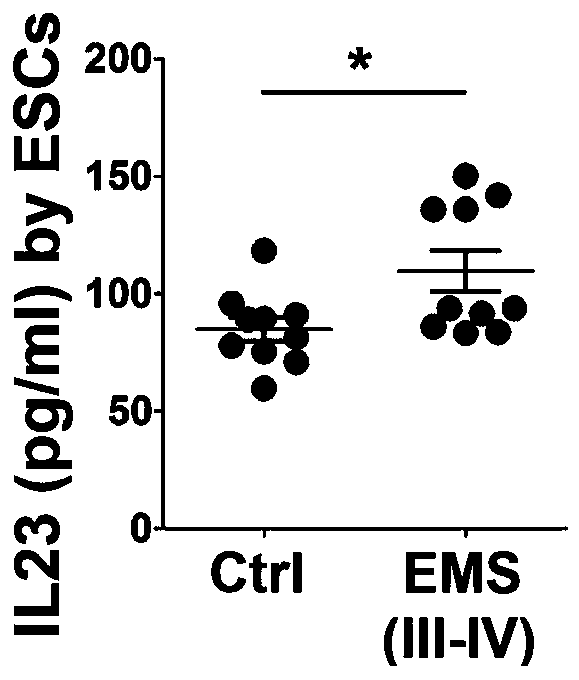 Application of interleukin-23 neutralizing antibody in preparation of endometriosis medicine