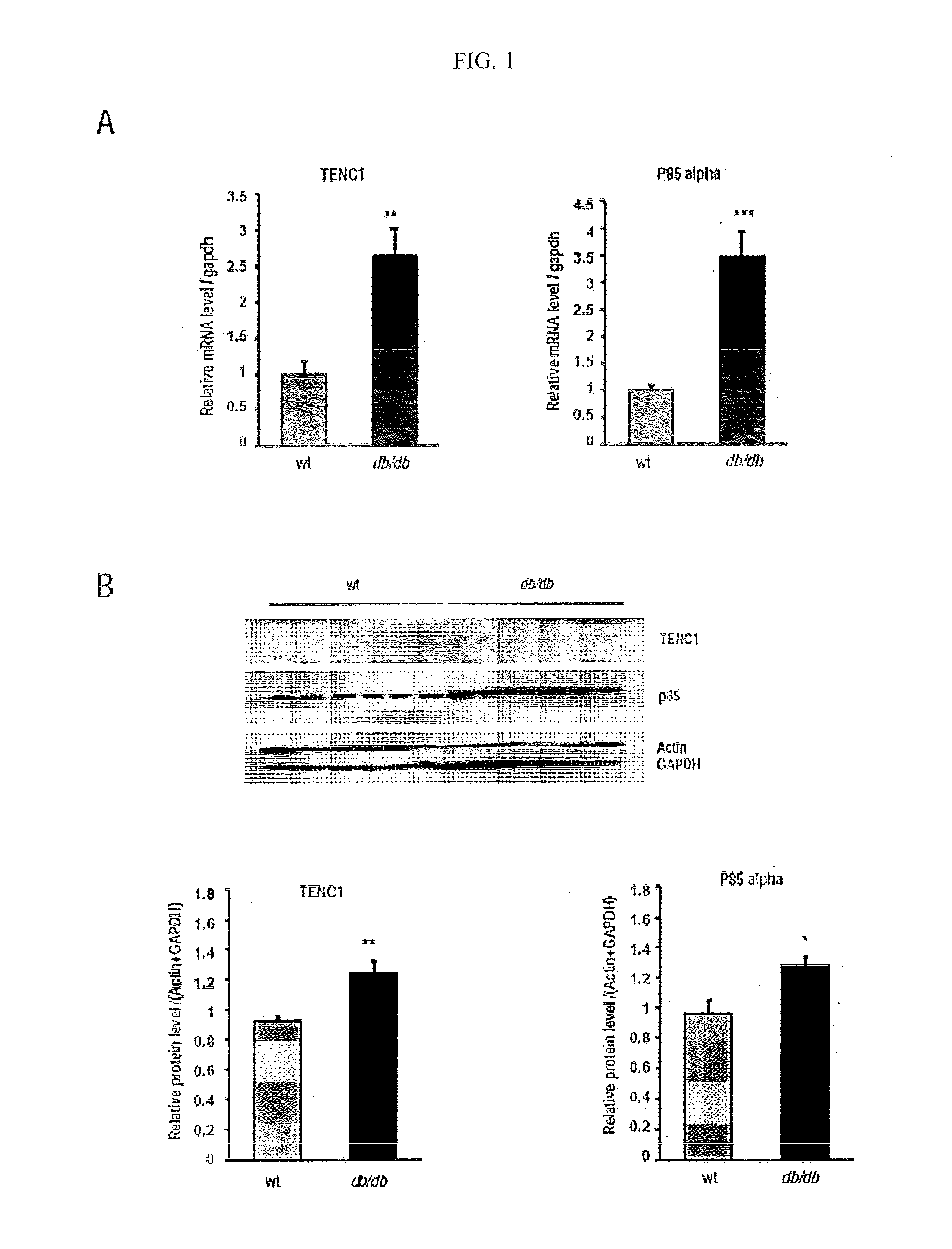 Pharmaceutical Composition for Preventing or Treating Diabetes Containing TENC1 Expression or Activity Suppressor