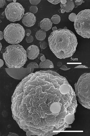 Preparation method of chitosan microspheres and application of chitosan microspheres for removing anionic surfactant