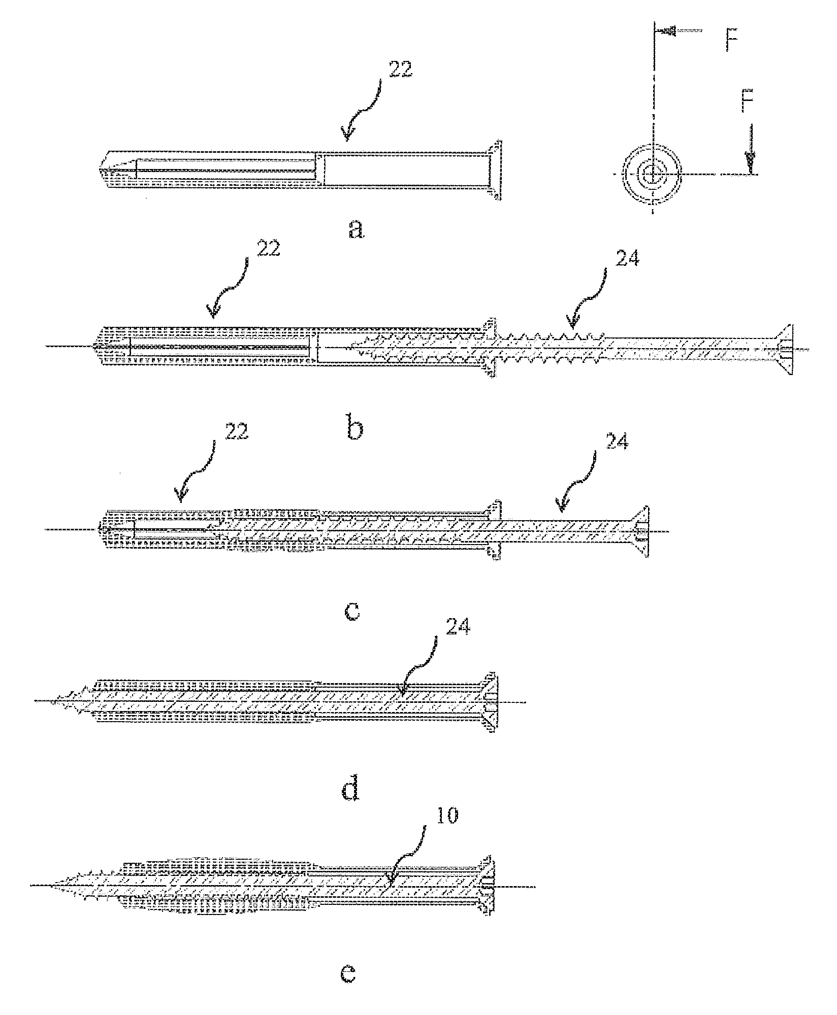 Anchoring System with a Sleeve Element and an Expansion Element