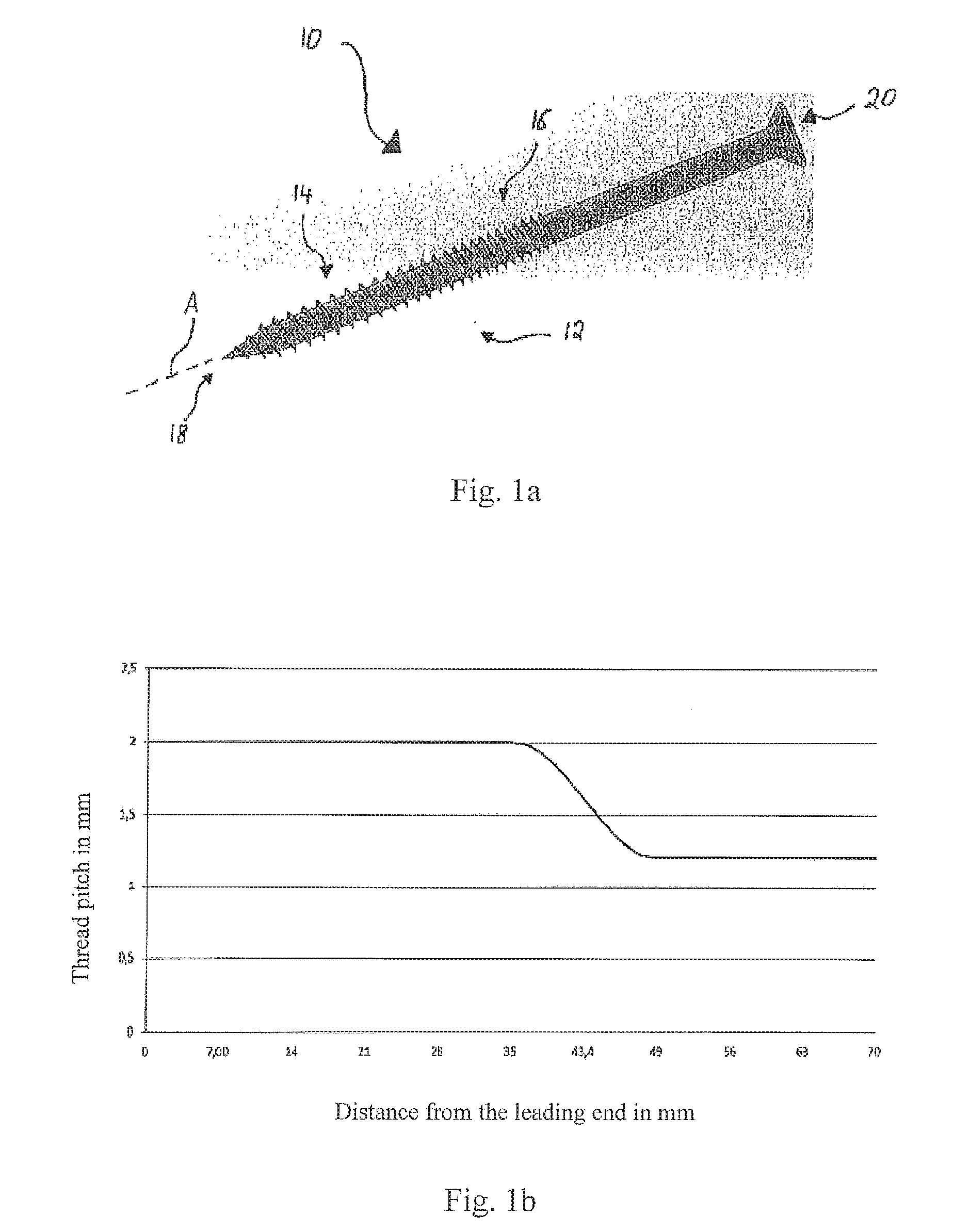 Anchoring System with a Sleeve Element and an Expansion Element