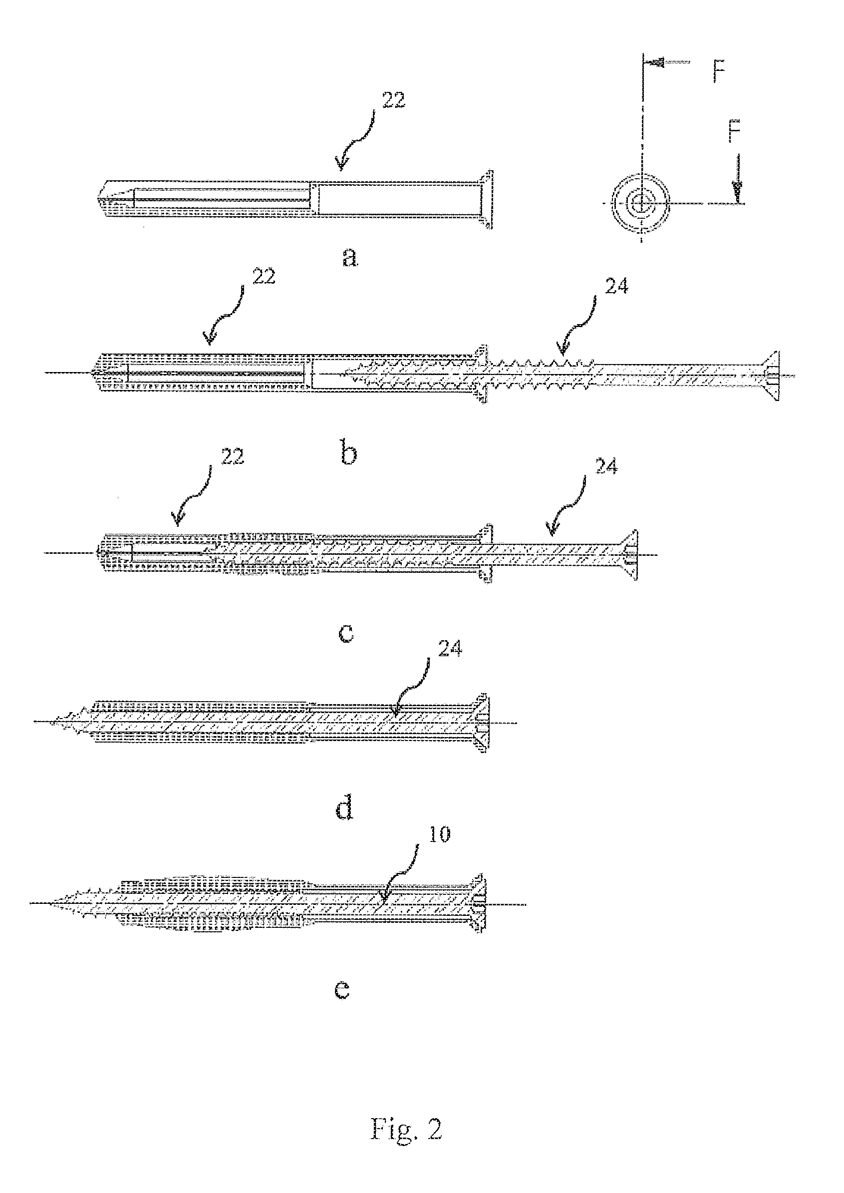 Anchoring System with a Sleeve Element and an Expansion Element