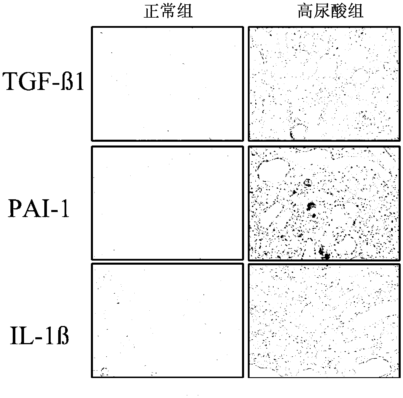 Method for constructing animal model of hyperuricemia induced renal interstitial fibrosis