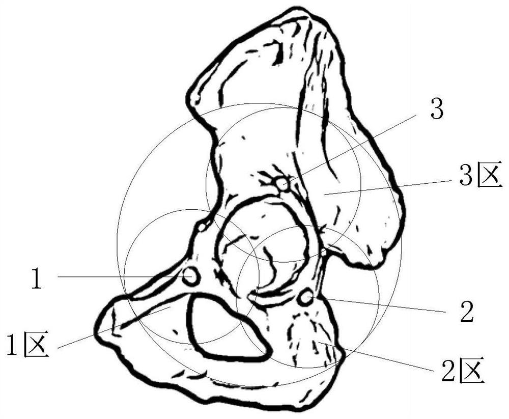 Pelvis registration method, pelvis registration device and pelvis registration system