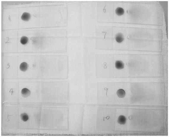 Treatment method of thick blood film of blood smear for plasmodium microscopic examination