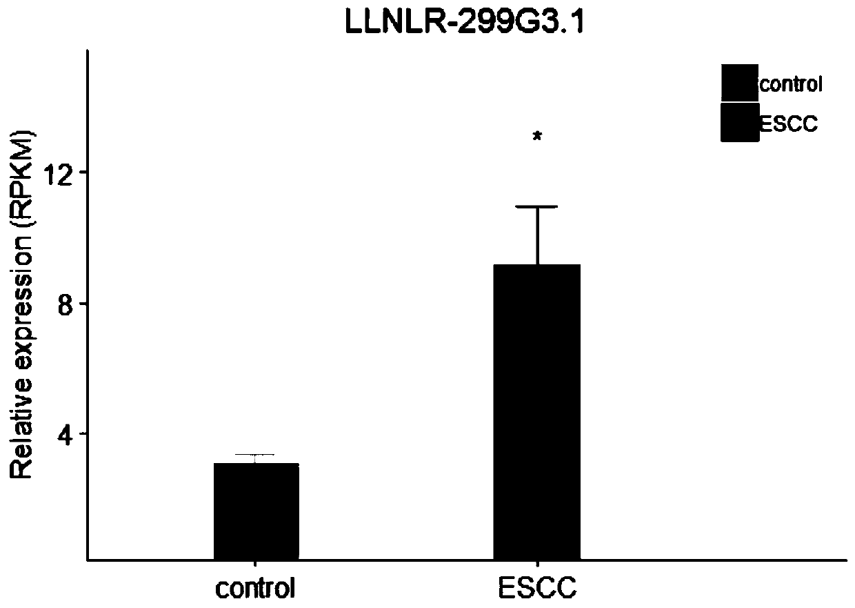 lncRNA LLNLR-299G3.1 related to esophageal squamous cell carcinoma (ESCC) and application thereof