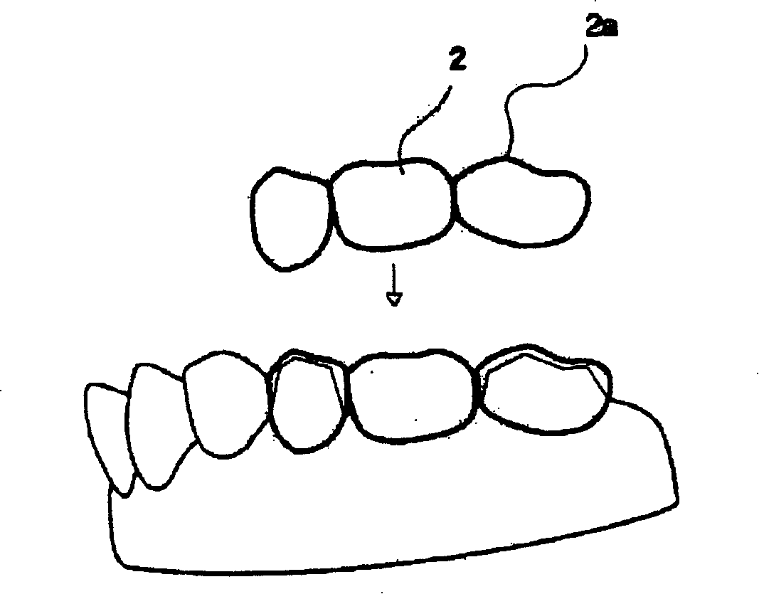 Dental prosthetic manufacturing method