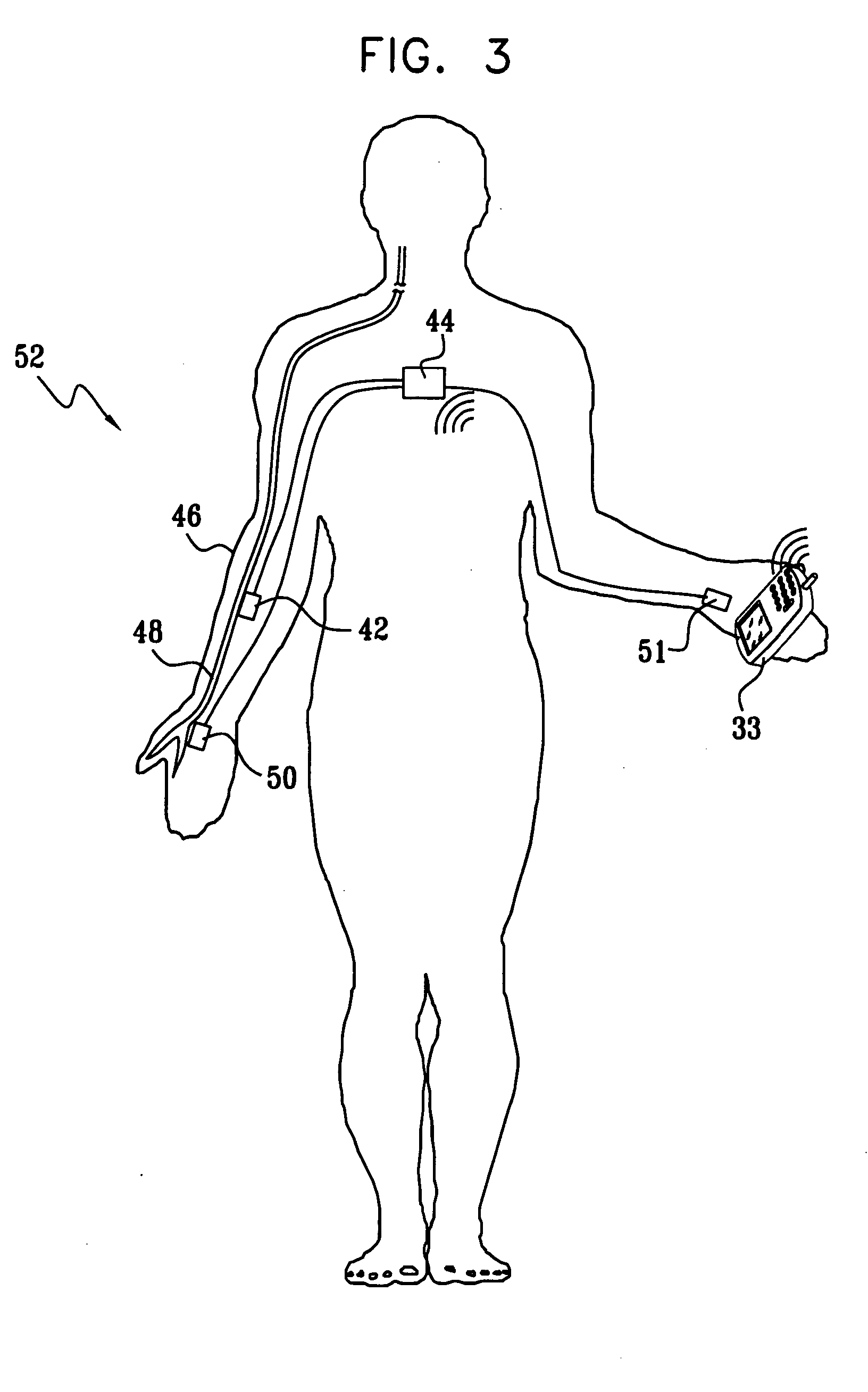 Actuation and control of limbs through motor nerve stimulation
