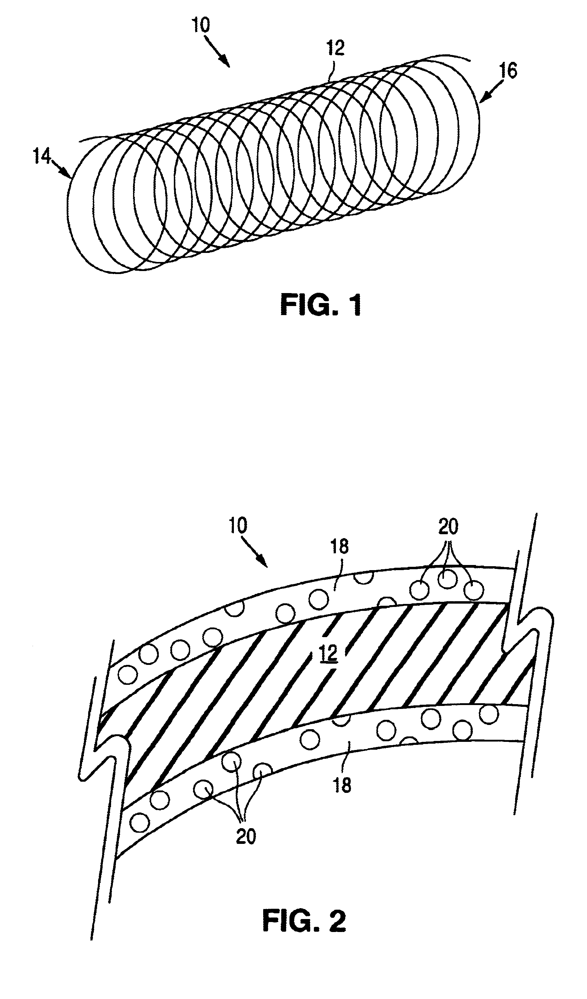 Microparticle coated medical device