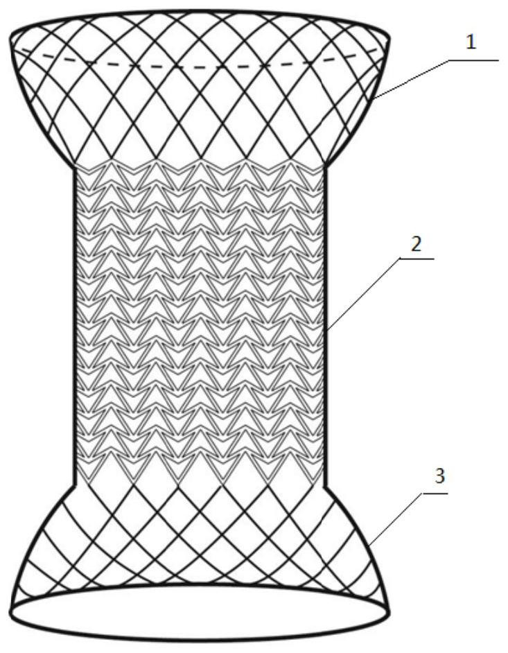 Anti-slip self-expanding degradable esophageal tube stent with negative Poisson's ratio structure and its preparation
