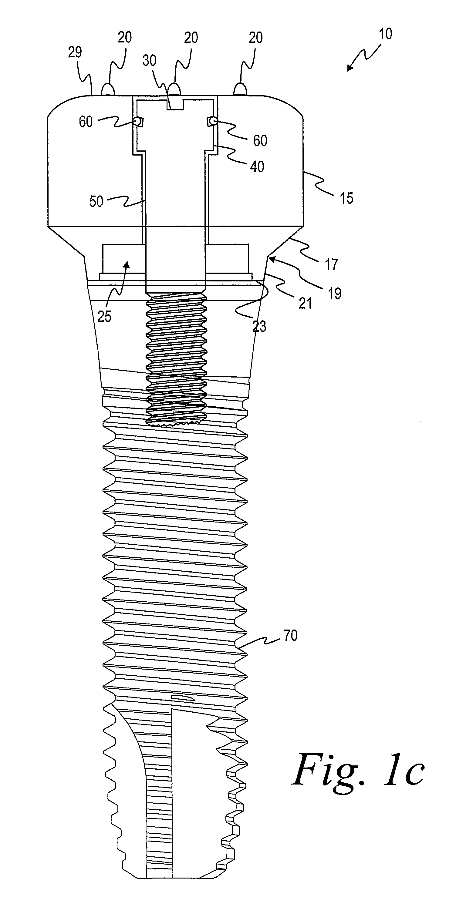 Method for manufacturing dental implant components