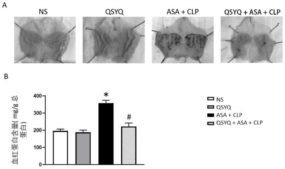 Application of traditional Chinese medicine astragalus membranaceus and radix salviae miltiorrhizae qi-tonifying preparation in treatment of gastrorrhagia