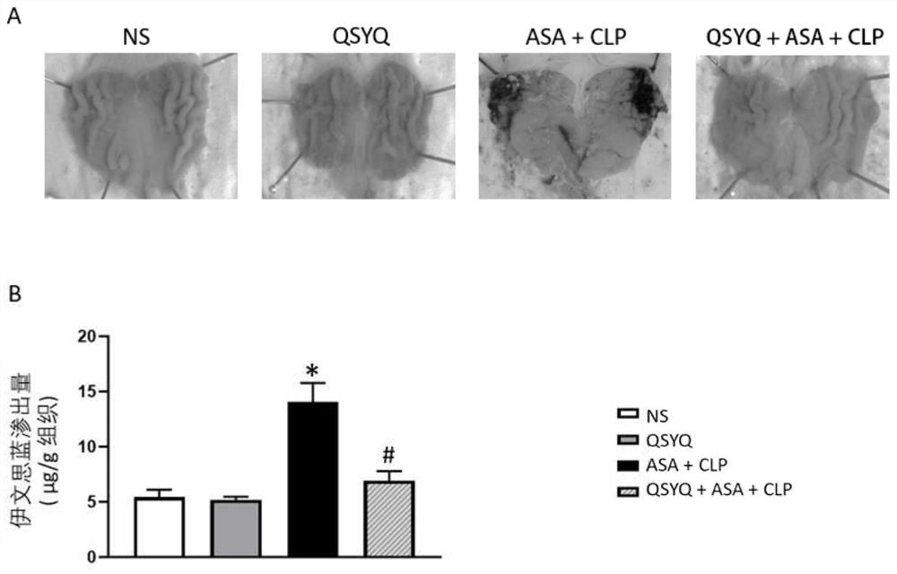 Application of traditional Chinese medicine astragalus membranaceus and radix salviae miltiorrhizae qi-tonifying preparation in treatment of gastrorrhagia