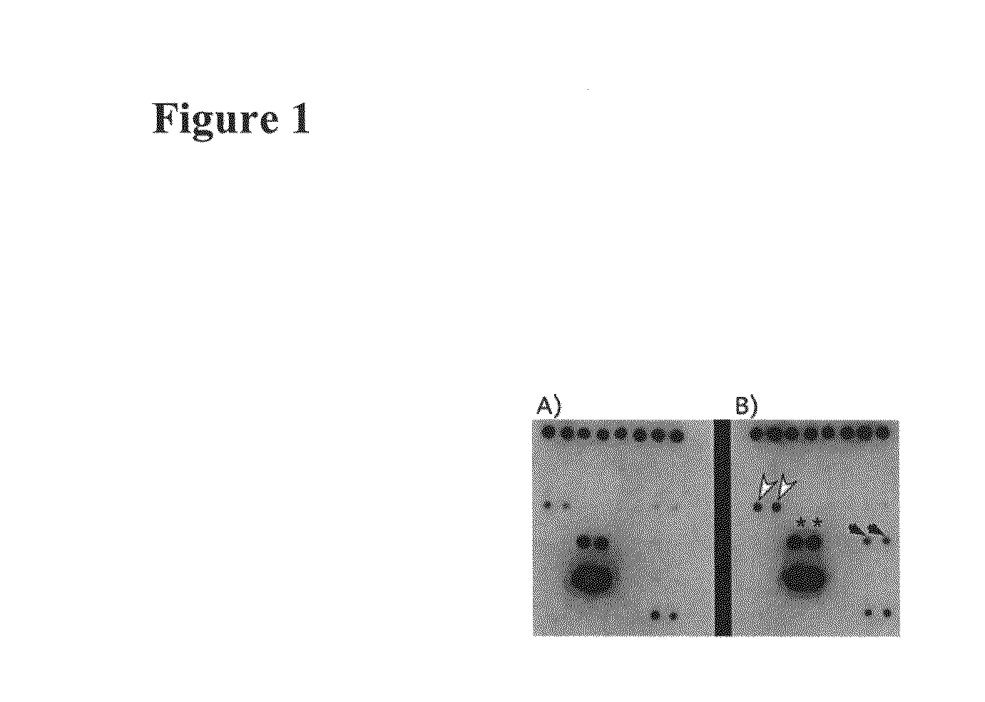 Methods and compositions for the treatment and diagnosis of vascular inflammatory disorders or endothelial cell disorders