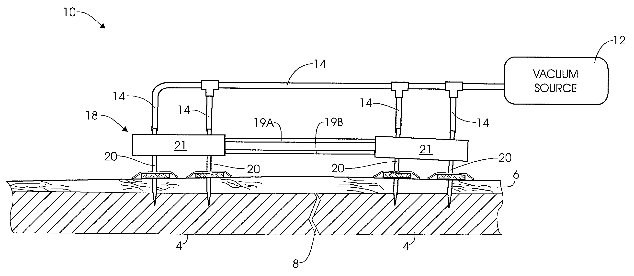 External fixation assembly and method of use