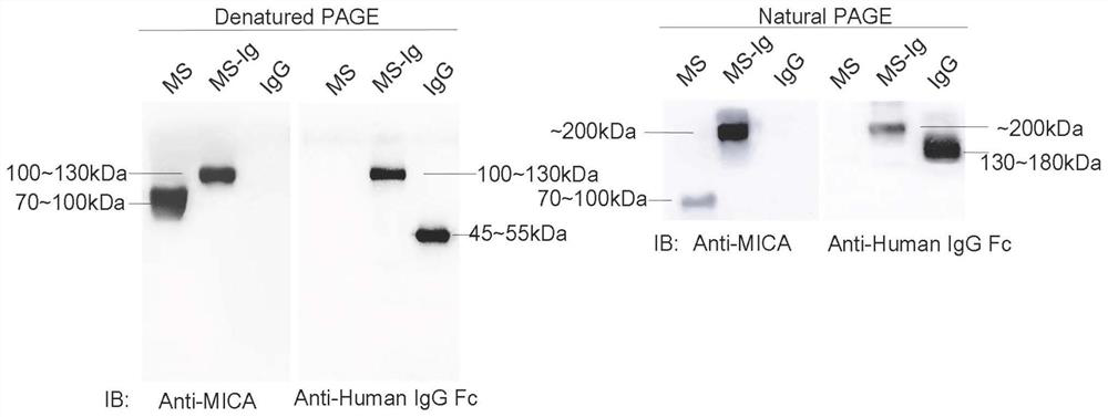 Soluble NK-CAR fusion protein as well as preparation method and application of soluble NK-CAR fusion protein in drug for mediating immune cells to kill tumor cells