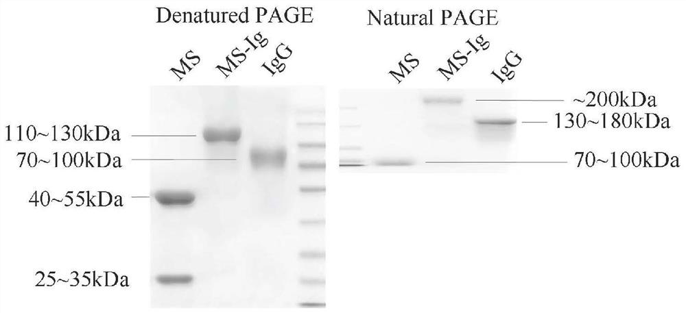 Soluble NK-CAR fusion protein as well as preparation method and application of soluble NK-CAR fusion protein in drug for mediating immune cells to kill tumor cells
