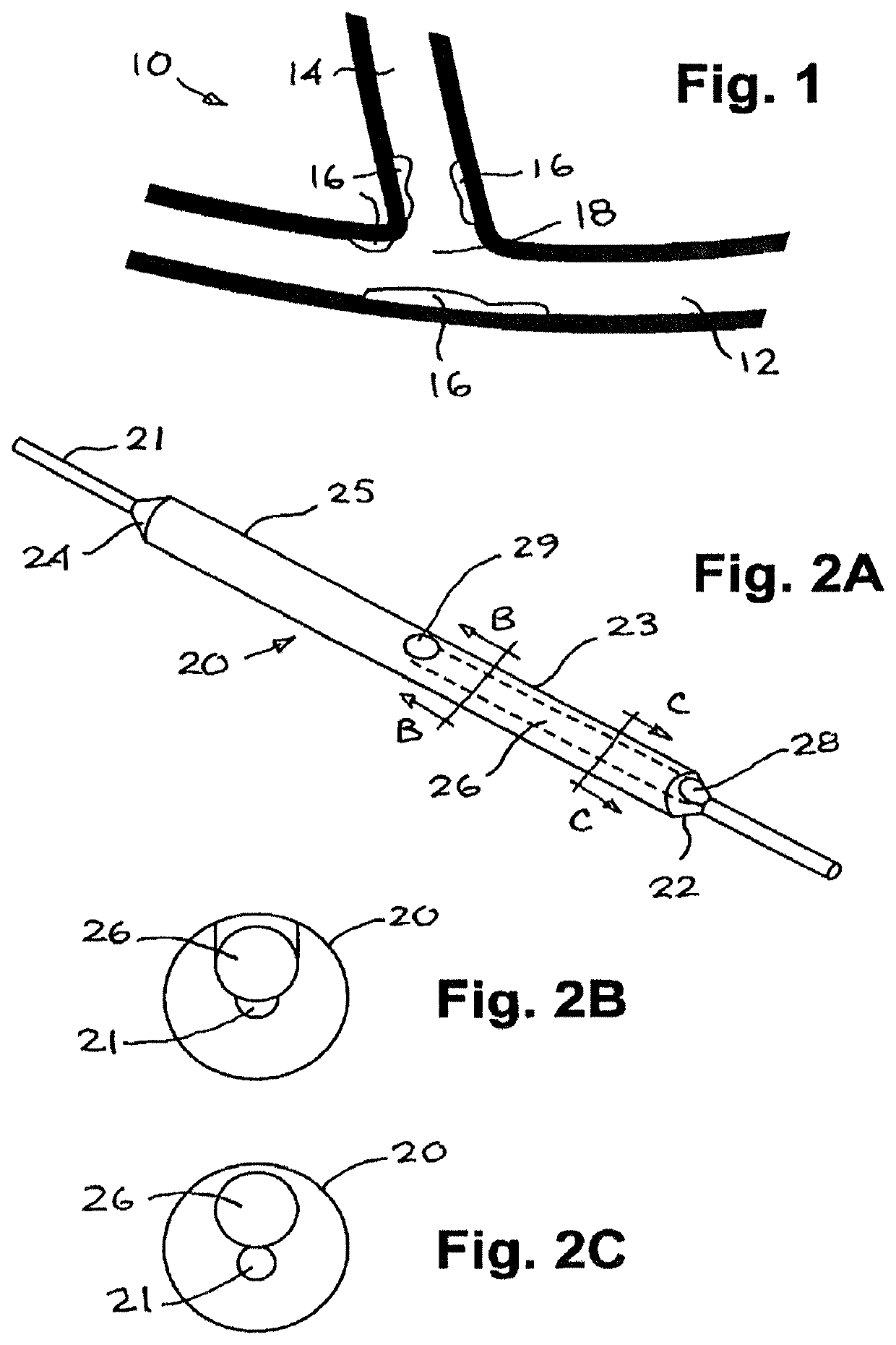 Bifurcated dual-balloon catheter system for bifurcated vessels