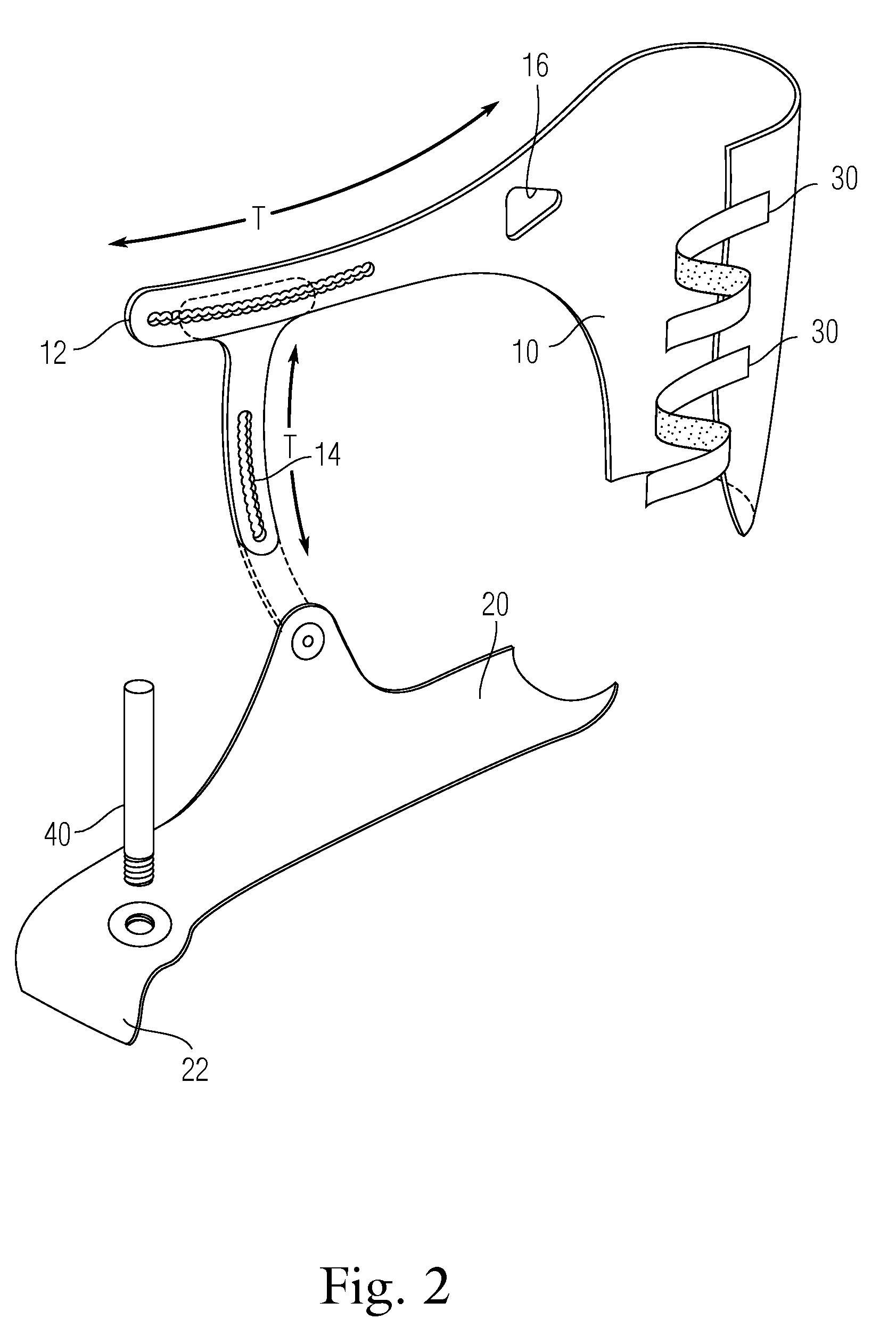 Extremity support apparatus and method